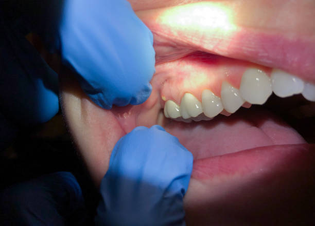 Professional Emergency Dental Service in MD