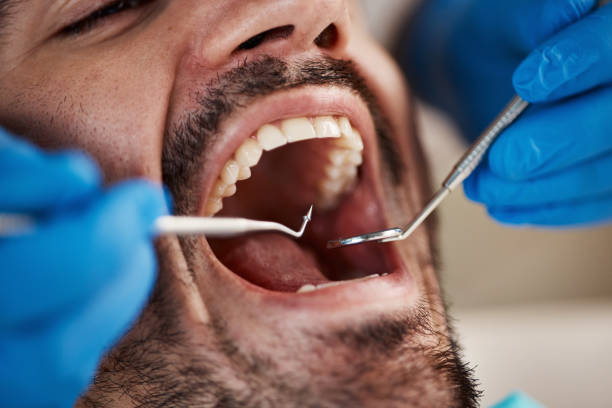 Best Emergency Care for Gum Disease in Flower Hill, MD